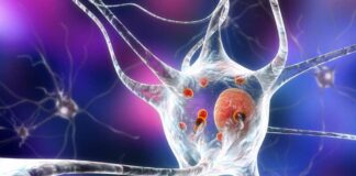 La nuova molecola scoperta a Dundee porta speranza per il Parkinson