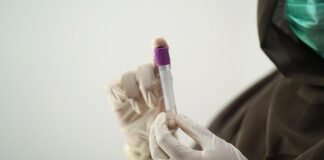 Giornata mondiale della lotta all’AIDS, i dati nel Veneto lotta all'AIDS