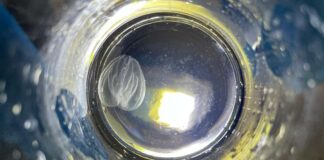 Laguna di Venezia, la noce di mare minaccia l’ecosistema noce di mare